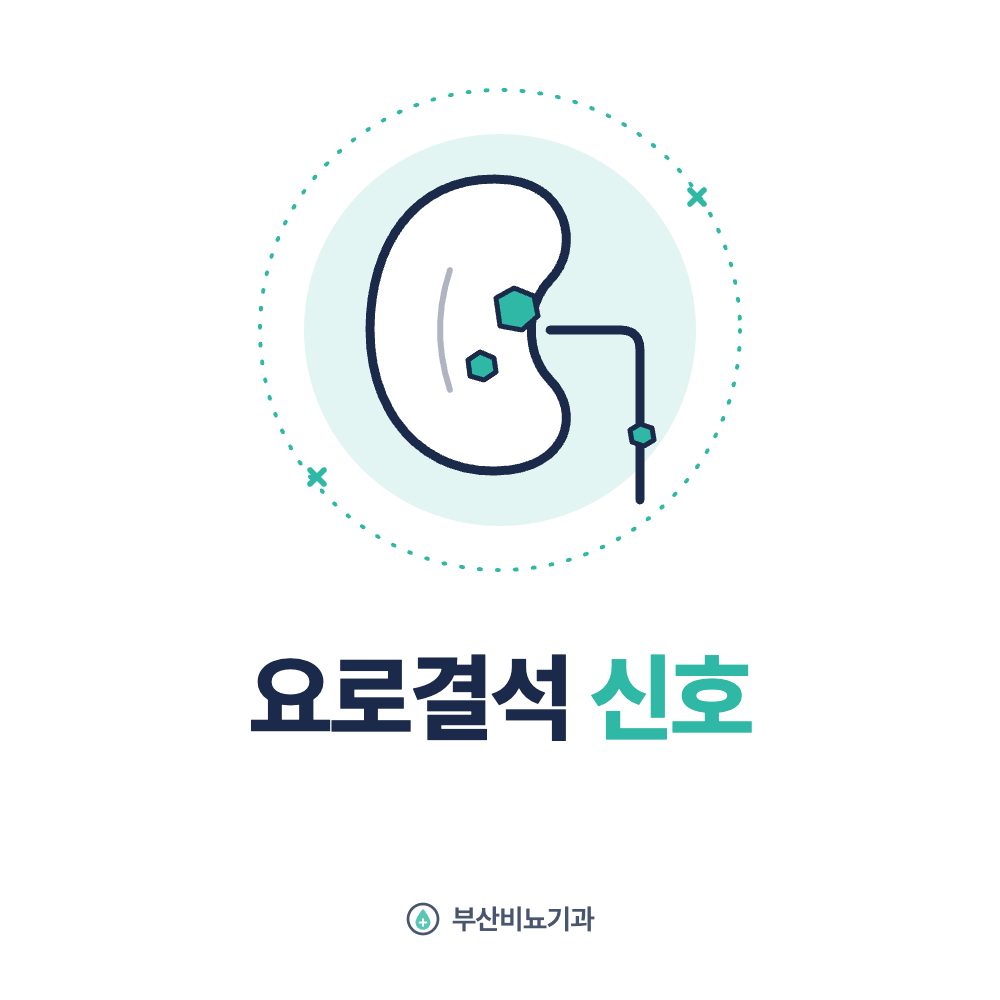 요로결석 신호